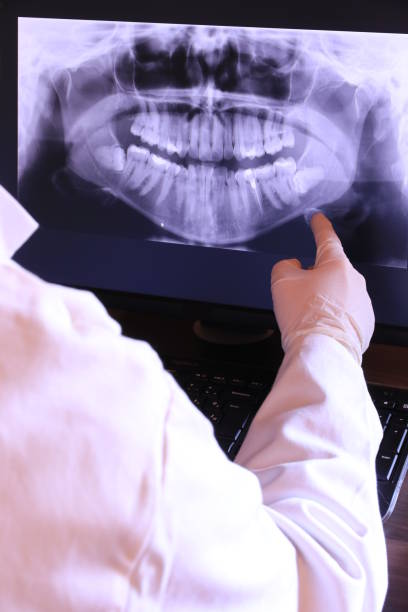 Best Emergency Dental Care for Abscessed Tooth in Henderson, GA