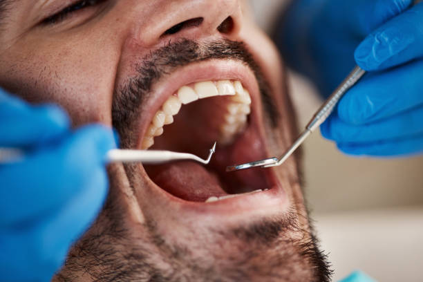 Best Orthodontic Emergency Dentist in Henderson, GA